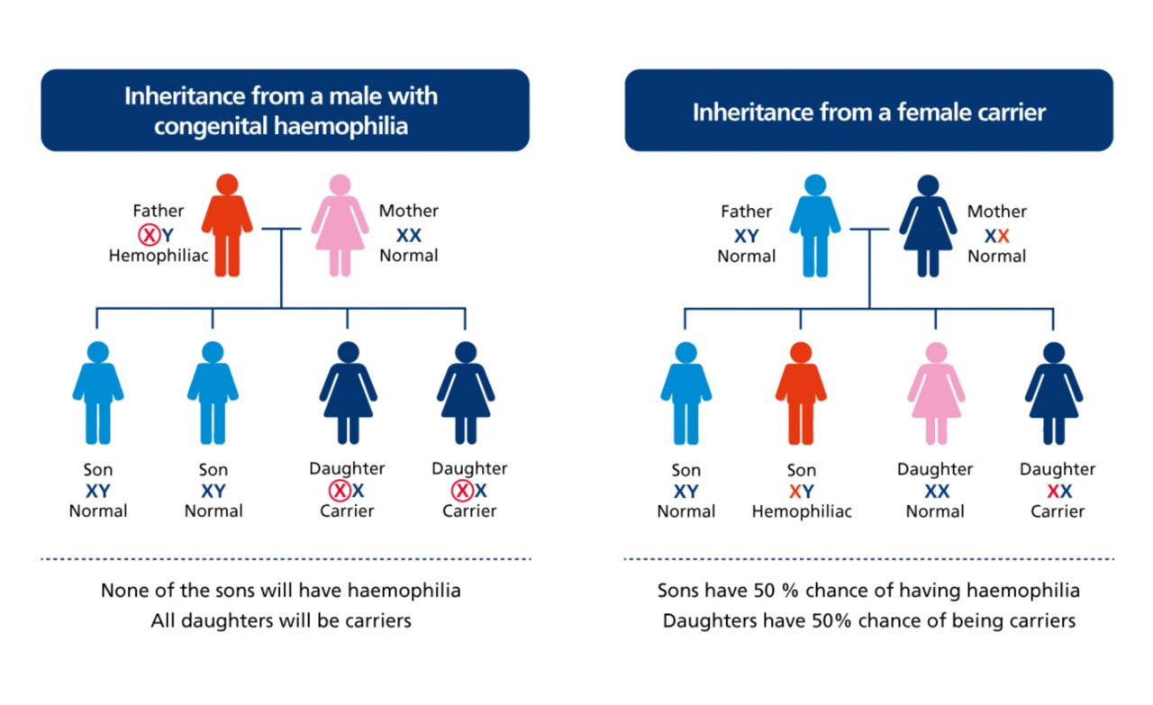 Understanding Haemophilia